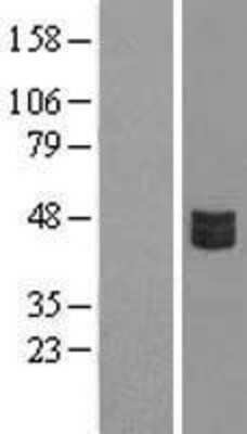 Western Blot: CRLF3 Overexpression Lysate [NBL1-09486]