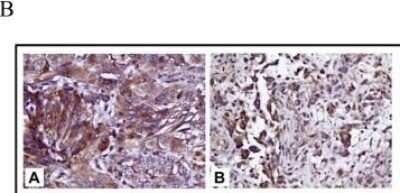 Immunohistochemistry: CRLR Antibody [NBP1-85643]