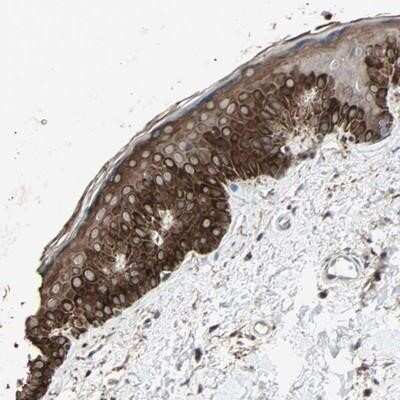 Immunohistochemistry-Paraffin: CRLR Antibody [NBP1-85643]