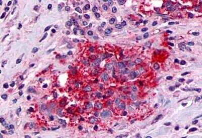 Immunohistochemistry-Paraffin: CRLR Antibody - BSA Free [NLS6731]
