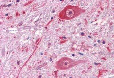 Immunohistochemistry-Paraffin: CRLR Antibody - BSA Free [NLS6731]
