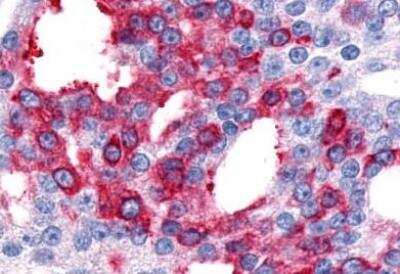 Immunohistochemistry-Paraffin: CRLR Antibody - BSA Free [NLS6755]