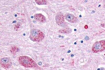 Immunohistochemistry-Paraffin: CRLR Antibody - BSA Free [NLS6755]