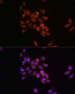 Immunocytochemistry/ Immunofluorescence: CRM1 Antibody (1J0L10) [NBP3-15823]