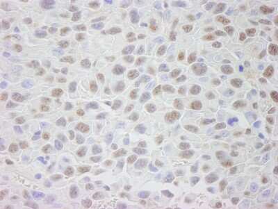 Immunohistochemistry: CRM1 Antibody [NB100-40862]
