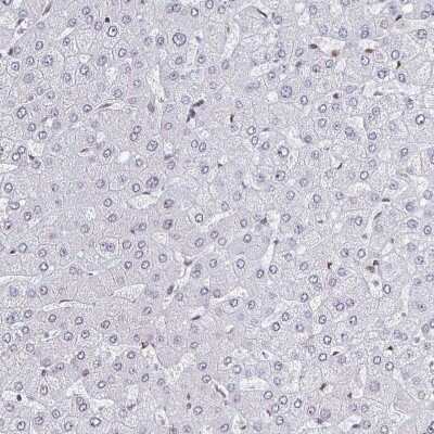 Immunohistochemistry-Paraffin: CRM1 Antibody [NBP2-33381]