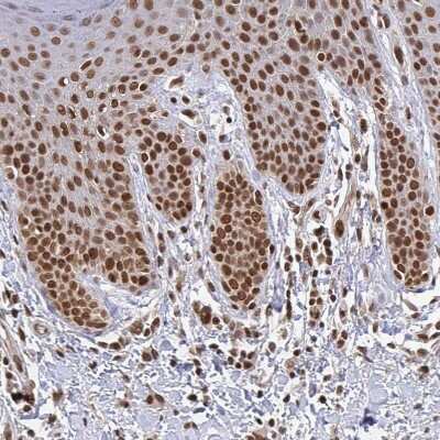 Immunohistochemistry-Paraffin: CRM1 Antibody [NBP2-33381]