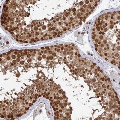 Immunohistochemistry-Paraffin: CRM1 Antibody [NBP2-33381]