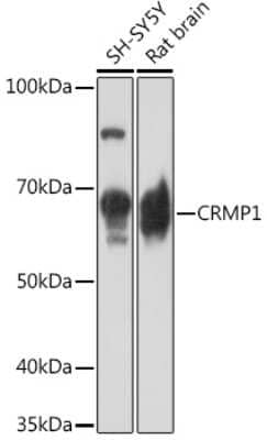 Western Blot: CRMP1 Antibody (1U7K3) [NBP3-16120]