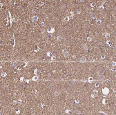 Immunohistochemistry-Paraffin: CRMP1 Antibody [NBP1-84985]