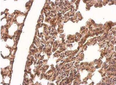 Immunohistochemistry-Paraffin: CRMP1 Antibody [NBP2-16015]