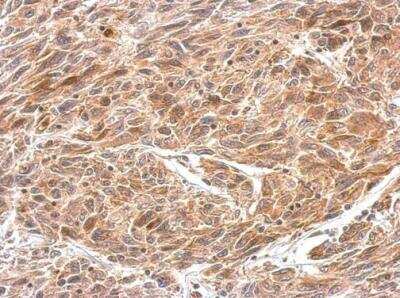 Immunohistochemistry-Paraffin: CRMP1 Antibody [NBP2-16015]