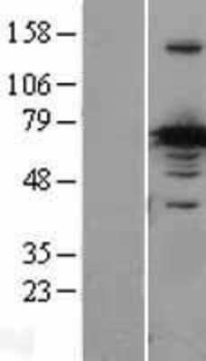 Western Blot: CRMP1 Overexpression Lysate [NBL1-09487]