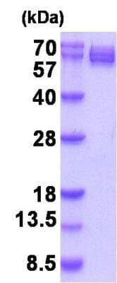 SDS-PAGE: Recombinant Human CRMP1 His Protein [NBP2-32062]