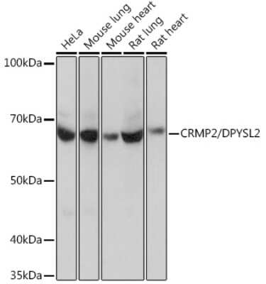 Western Blot: CRMP2 Antibody (0A1T1) [NBP3-16406]