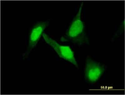 Immunocytochemistry/ Immunofluorescence: CRMP2 Antibody (1F11) [H00001808-M01]