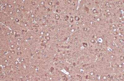 Immunohistochemistry-Paraffin: CRMP2 Antibody [NBP1-31762]