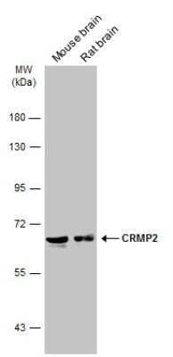Western Blot: CRMP2 Antibody [NBP1-31762]