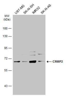 Western Blot: CRMP2 Antibody [NBP1-31762]