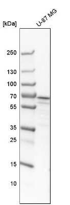 Western Blot: CRMP2 Antibody [NBP1-85448]