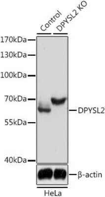 Western Blot: CRMP2 AntibodyAzide and BSA Free [NBP2-92939]