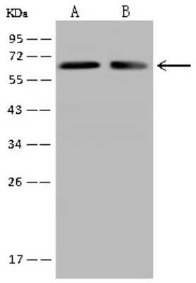 Western Blot: CRMP2 Antibody [NBP2-97750]