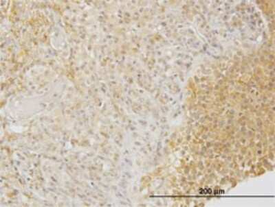 Immunohistochemistry-Paraffin: CRMP4 Antibody (1B8) [H00001809-M01]