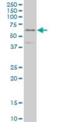 Western Blot: CRMP4 Antibody (1B8) [H00001809-M01]