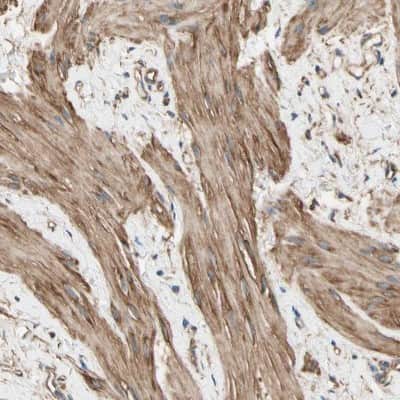 Immunohistochemistry-Paraffin: CRMP4 Antibody [NBP1-85447]