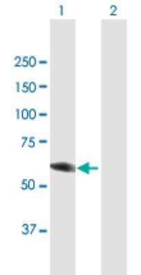 Western Blot: CRMP4 Antibody [H00001809-B01P]