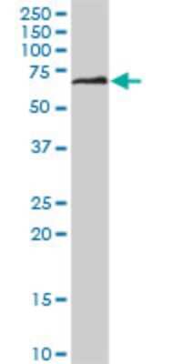 Western Blot: CRMP5 Antibody (2D10) [H00056896-M04]