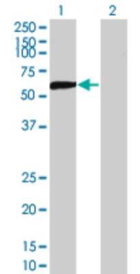 Western Blot: CRMP5 Antibody (2G4) [H00056896-M02]