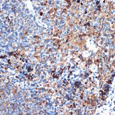 Immunohistochemistry-Paraffin: CRMP5 Antibody (5L4S8) [NBP3-16204]