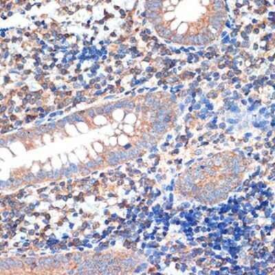 Immunohistochemistry-Paraffin: CRMP5 Antibody (5L4S8) [NBP3-16204]