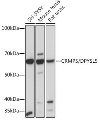 Western Blot: CRMP5 Antibody (5L4S8) [NBP3-16204]