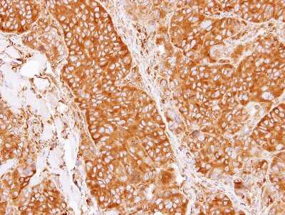 Immunohistochemistry-Paraffin: CRMP5 Antibody [NBP1-33419]
