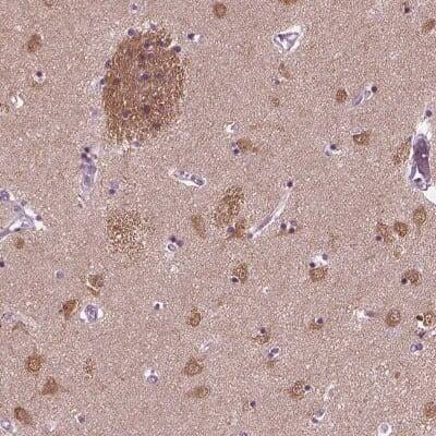 Immunohistochemistry-Paraffin: CRMP5 Antibody [NBP1-85461]