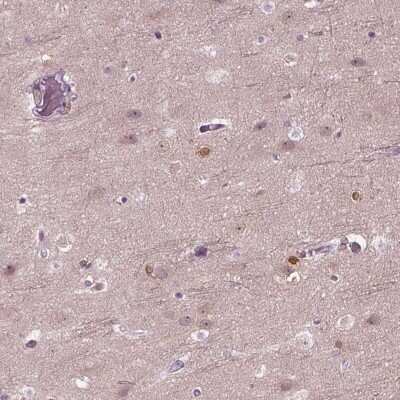Immunohistochemistry-Paraffin: CRMP5 Antibody [NBP1-85461]