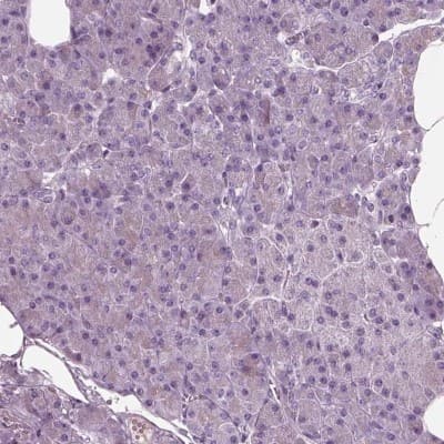 Immunohistochemistry-Paraffin: CRMP5 Antibody [NBP1-85461]