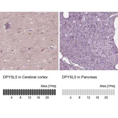 Immunohistochemistry-Paraffin: CRMP5 Antibody [NBP1-85461]