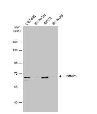 Western Blot: CRMP5 Antibody [NBP1-33419]