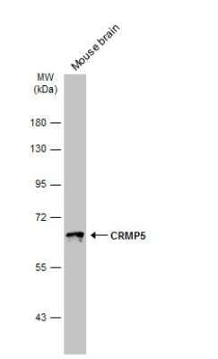 Western Blot: CRMP5 Antibody [NBP1-33419]