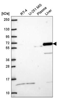 Western Blot: CRMP5 Antibody [NBP2-55982]