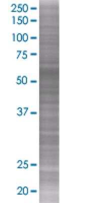 SDS-PAGE: CRMP5 293T Cell Transient Overexpression Lysate [H00056896-T01]