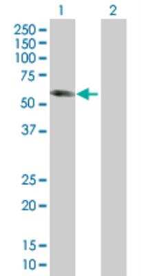 Western Blot: CRMP5 293T Cell Transient Overexpression Lysate [H00056896-T01]