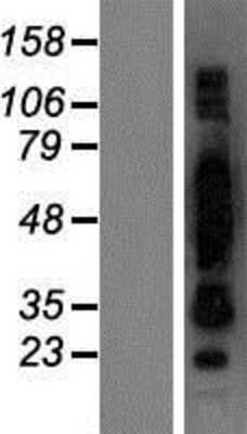 Western Blot: Cornulin Overexpression Lysate [NBP2-07077]