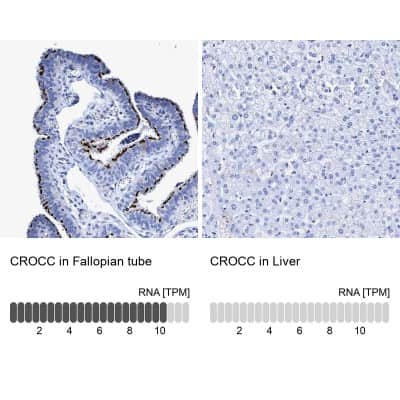 Immunohistochemistry-Paraffin: CROCC Antibody [NBP1-80820]