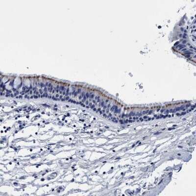 Immunohistochemistry-Paraffin: CROCC Antibody [NBP1-80821]
