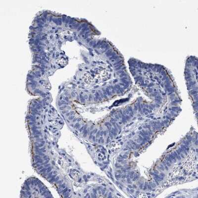 Immunohistochemistry-Paraffin: CROCC Antibody [NBP1-80821]