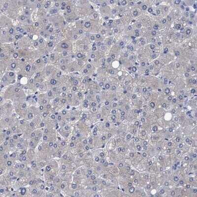 Immunohistochemistry-Paraffin: CROCC Antibody [NBP1-80821]